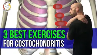 3 Best Exercises for Costochondritis