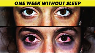 What Happens If You DON'T SLEEP for ONE WEEK?