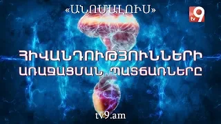 Հիվանդությունների առաջացման պատճառները․ «Անոմալուս» Կարեն Եմենջյանի հետ