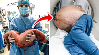 Shocked Doctors Remove 30 Pounds Of Poop Built Up For 22 Years