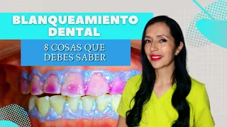 Blanqueamiento dental. 8 cosas que debes saber antes de hacertelo