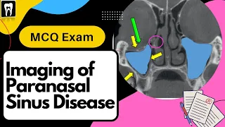 Oral Radiology Practice questions | Paranasal sinus disease imaging