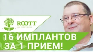 😀 16 имплантов за 1 прием - Отзыв пациента об имплантации зубов в клинике ROOTT