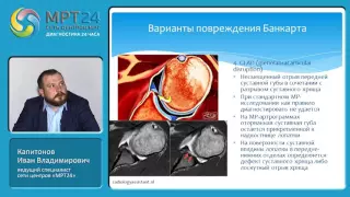 "МРТ-диагностика травм и патологий плечевого сустава", Капитонов Иван Владимирович.