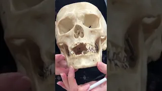 Skull Foramen on anterior face