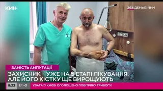Bone regeneration technology: в Україні рятують українських військових від ампутації та протезування
