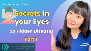 20 Hidden Diseases Revealed by Eye Exams | Part 1| Eye Surgeon Explains #draudreytai