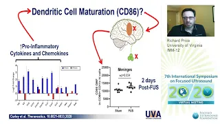 Richard Price - Immunomodulation of Intracranial Melanoma in Response to BTB Opening with FUS (2020)