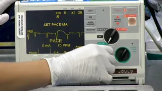 Transcutaneous cardiac pacing in a patient with third-degree heart block