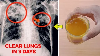 How to Remove Tar from Lungs After Smoking - Natural Recipe to Clear Lungs in 3 Days