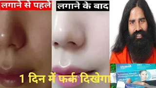 गोरा होने वाली क्रीम रातो रात फर्क नज़र आएगा| ultra bright triple action cream| whitening क्रीम