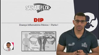 Doença Inflamatória Pélvica (DIP) - Parte 1 - Aula SanarFlix