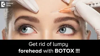 Treatment of lumpy forehead with botox injections - Dr. Rajdeep Mysore