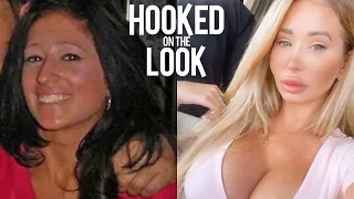 I've Spent $100K On My Plastic Surgery Transformation | HOOKED ON THE LOOK