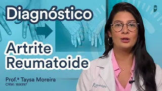 Revisando o Diagnóstico da Artrite Reumatoide - Reumatologia