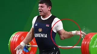 Top 5 Most GRUESOME Weightlifting Injuries