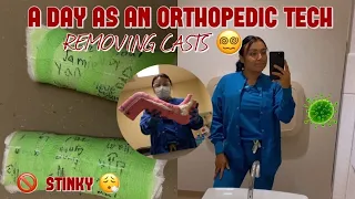 A DAY AS AN ORTHOPEDIC TECH REMOVING CASTS