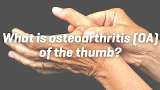 What is osteoarthritis (OA) of the thumb?