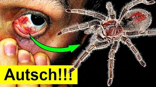 Das passiert, wenn Du Spinnenhaare ins Auge bekommst