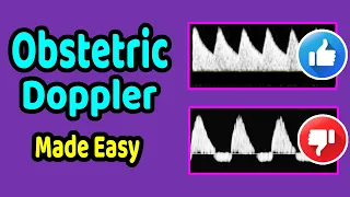 Obstetric Doppler Made Easy