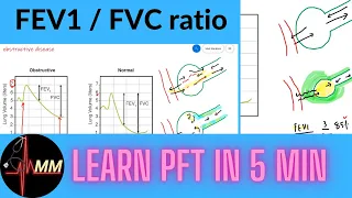 Pulmonary function test | Spirometry | obstructive vs restrictive disease | | Respiratory Physiology