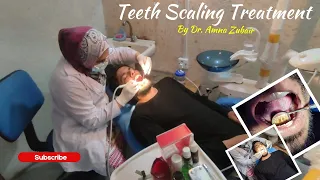 Teeth Scaling Treatment by Dr. Amna Zubair | Vlog 013