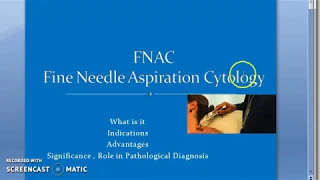 Pathology 918 a FNAC Fine Needle Aspiration Cytology Diagnostic Pathology InterVention