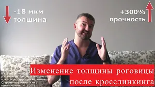 Изменение толщины роговицы после кросслинкинга (увеличение и уменьшение пахиметрии) при кератоконусе