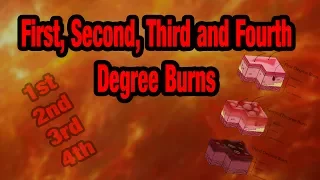 How To Grade BURNS - 1st, 2nd, 3rd and 4th Degree Burns Explained