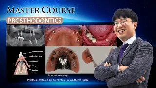 [Master Course - PROSTHODONTICS] Treatment planning of the edentulous mandible