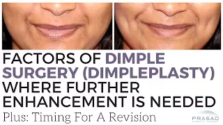 Factors that May Affect Dimple Creation Surgery, and the Ideal Time for Enhancement or Revision