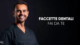 FACCETTE DENTALI "FAI DA TE" - Il risultato vale il risparmio?