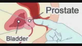 Male G Spot   How To Reach Prostate Orgasm