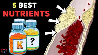 Top 5 Miracle Nutrients That Quickly Remove Arterial Plaque | Vitality Solutions