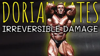 He's Suffered Irreversible Damage From Bodybuilding || Dorian Yates