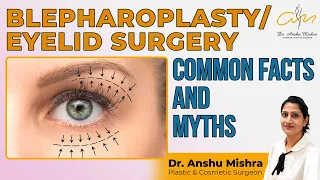 Blepharoplasty Lower Lid Recovery | Common Myths & Facts | Eyelid Surgery | Plastic Surgery In Dubai