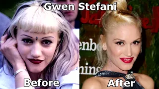 Celebrities before and after plastic surgery [2022]