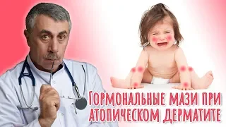 Гормональные мази при атопическом дерматите - Доктор Комаровский