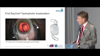 First global RayOne Hydrophobic implantation Post CE Mark by Professor Thomas Kohnen, MD, PhD, FEBO