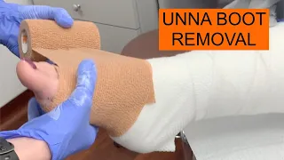 Wound Care UNNA BOOT Removal Tutorial