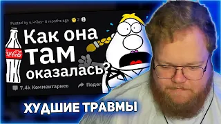 РЕАКЦИЯ T2x2: Врачи Рассказывают о ХУДШИХ Травмах из-за Ceк$@ #1