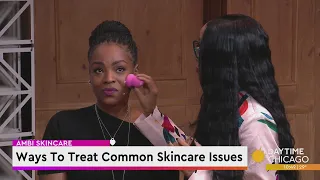 Ways To Treat Common Skincare Issues
