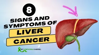 8 Signs and Symptoms of Liver Cancer