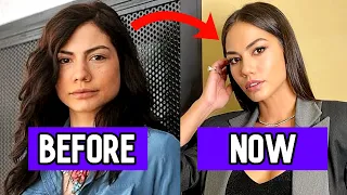 Turkish Actresses Before and After Plastic Surgery 2024