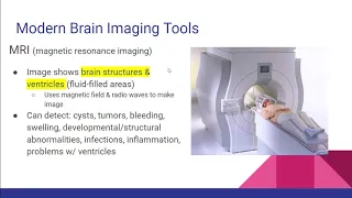 2.3 - Brain Imaging Tools - AP Psychology