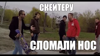 30-ти Летний скейт НАПАЛ на КОЛЯНА !