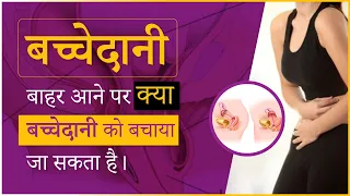 बच्चेदानी बाहर आने का इलाज क्या है और कैसे करते है ? Know  Prolapse By  Dr Sushila Saini