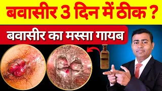 क्या बवासीर ३  दिन में ठीक हो सकता है ? बवासीर की दवा #pilestreatment #fissuretreatment