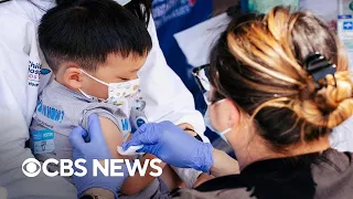 Vaccine hesitancy sparks measles, chickenpox rise