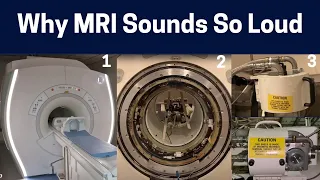 What Makes The Loud Scan Sounds in MRI Machines?